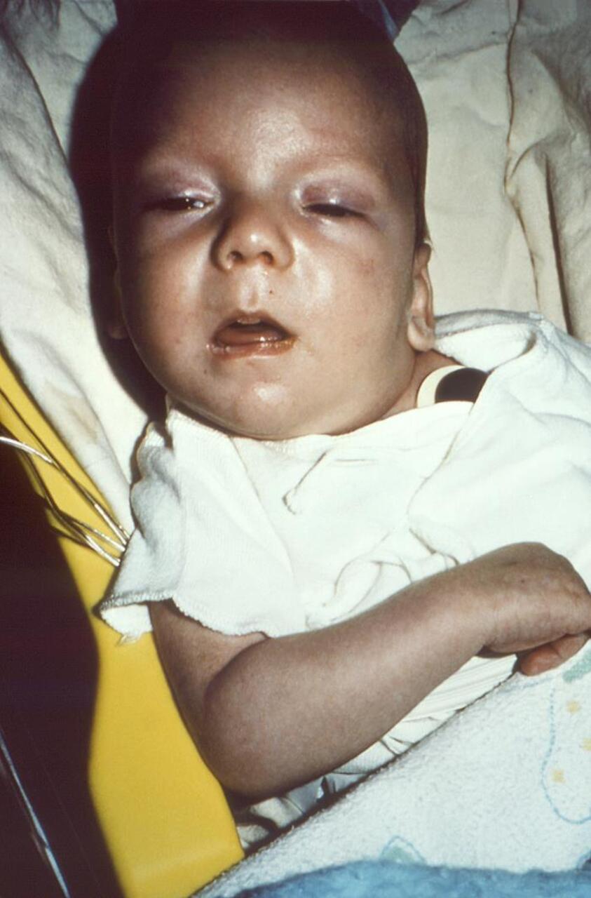 CDC/ Dr. V.R. Dowell, Jr., Public domain/Wikimedia Commons/Custom