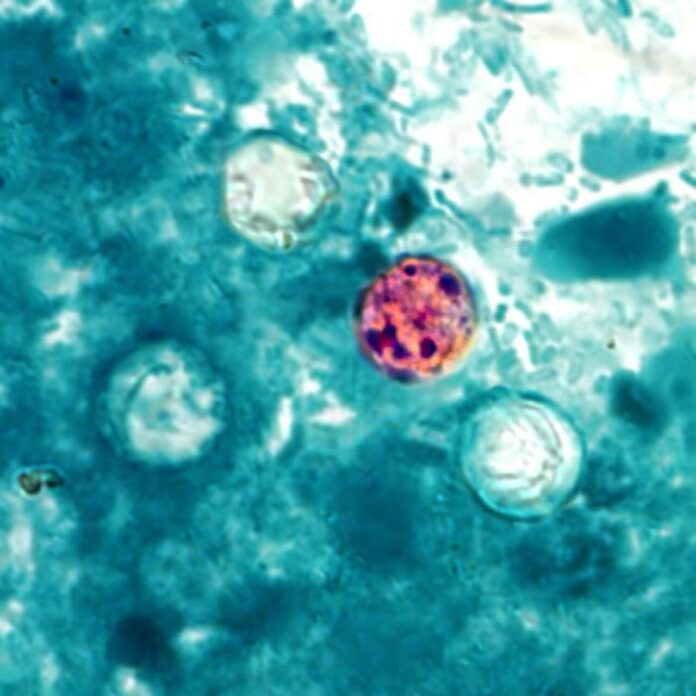 Cyclospora_cayetanensis (1)